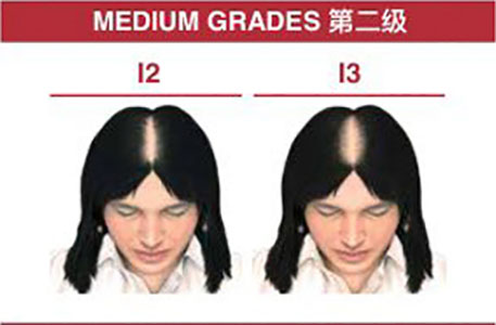 ӆ�ι���ϵ�y(t��ng)