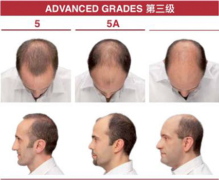 ӆ�ι���ϵ�y(t��ng)